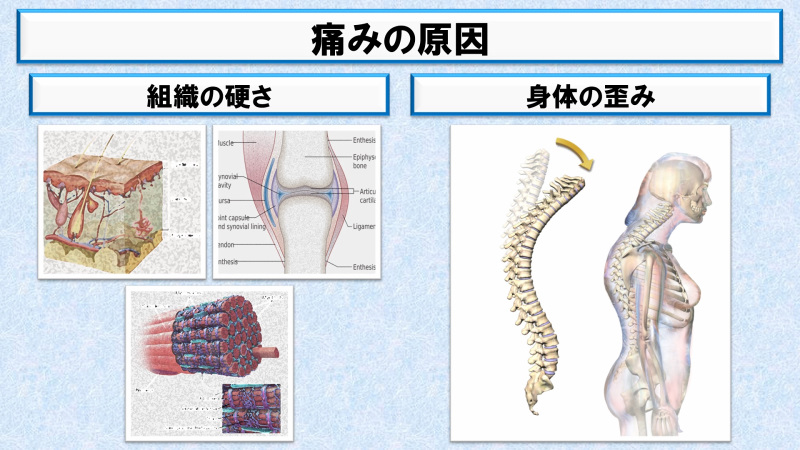 痛みの原因を説明した画像