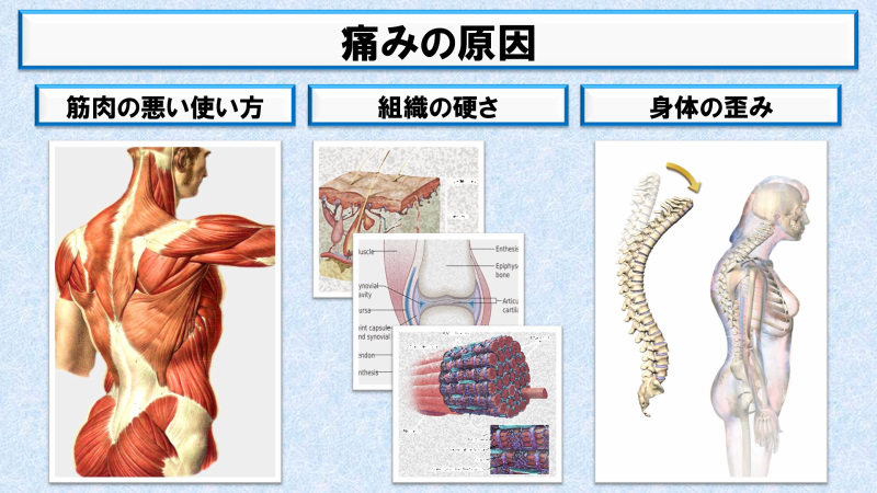 痛みの根本的な原因を説明した画像