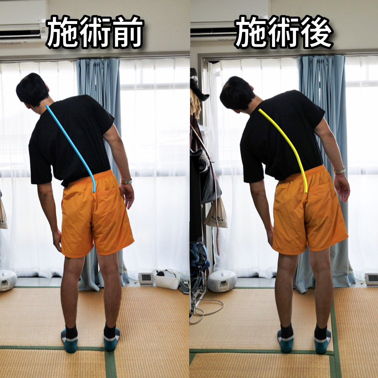 豊中整体Refreshのお客様の声3